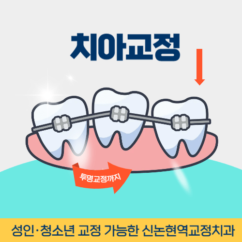 속초치과 속초시 치과 치아교정