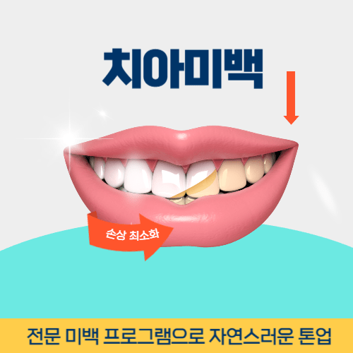 속초치과 속초시 치과 치아미백