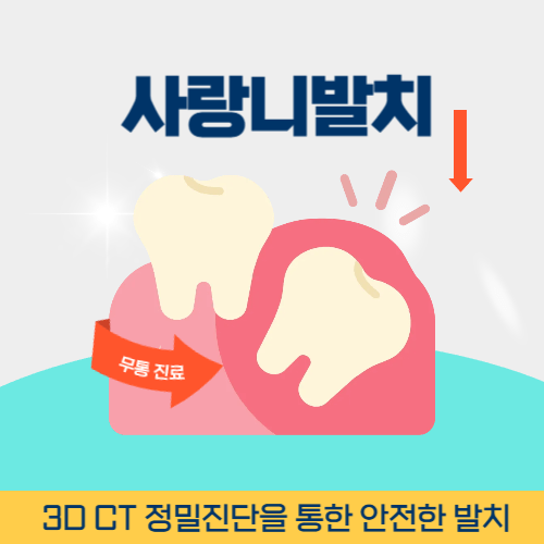 속초치과 속초시 치과 사랑니 발치