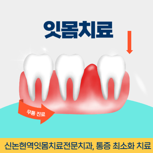 속초치과 속초시 치과 잇몸치료